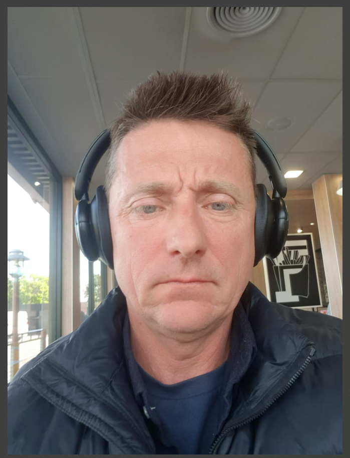 Image of red face from niacin flush